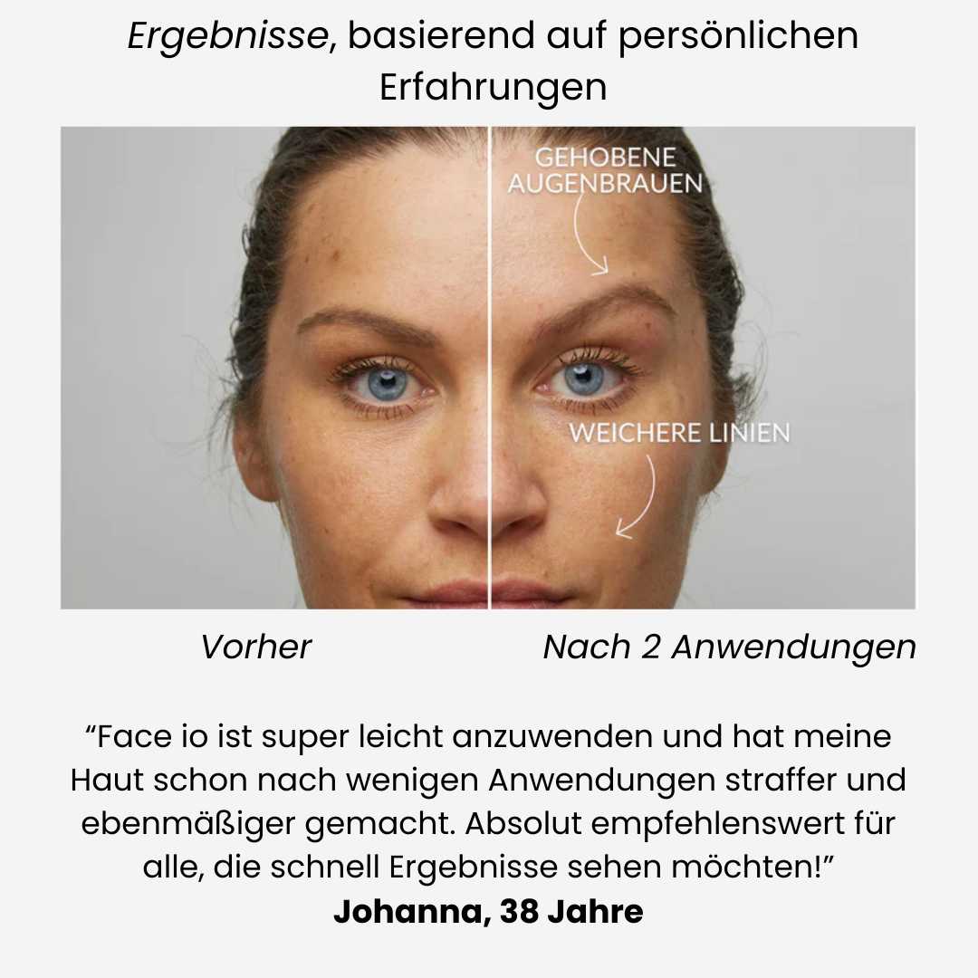 Face-iO  Glätten, Straffen, Reinigen für strahlende Haut